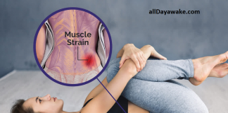 BEST WAY TO TREAT MUSCLE STRAIN
