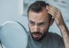 can stress cause hair loss- Can stress cause hair loss and what treatment for it?