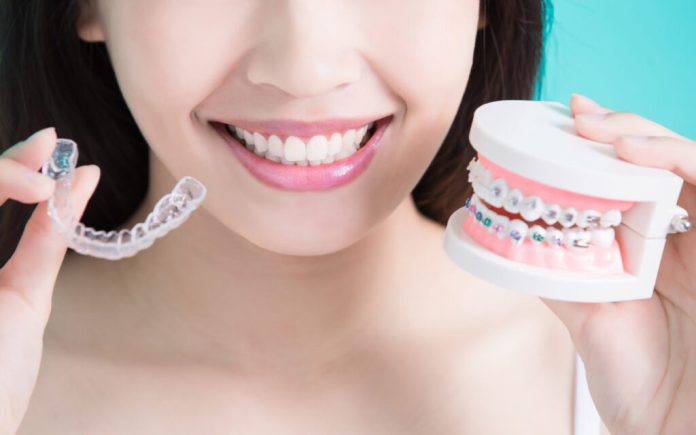 Clear Invisible Braces