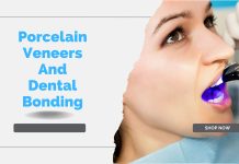Veneers vs. Dental bonding