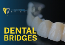 London Dental Bridges