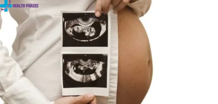 intrauterine pregnancy meaning